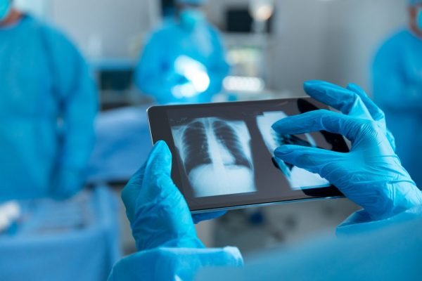 Doctor wearing surgical gloves looking at lung x-ray on tablet